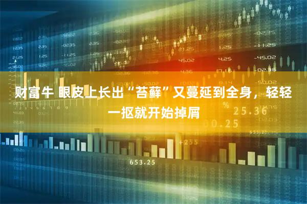 财富牛 眼皮上长出“苔藓”又蔓延到全身，轻轻一抠就开始掉屑
